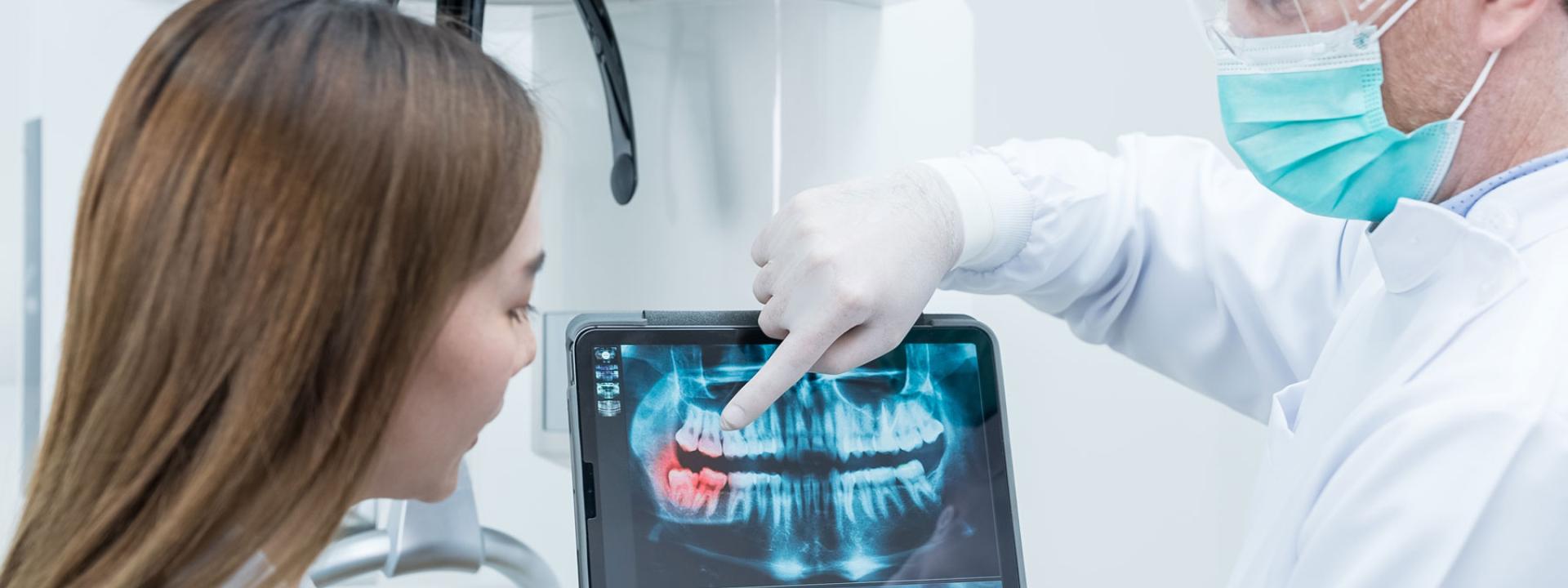 Dental diagnostics: How do digital X-rays work, and why are they done